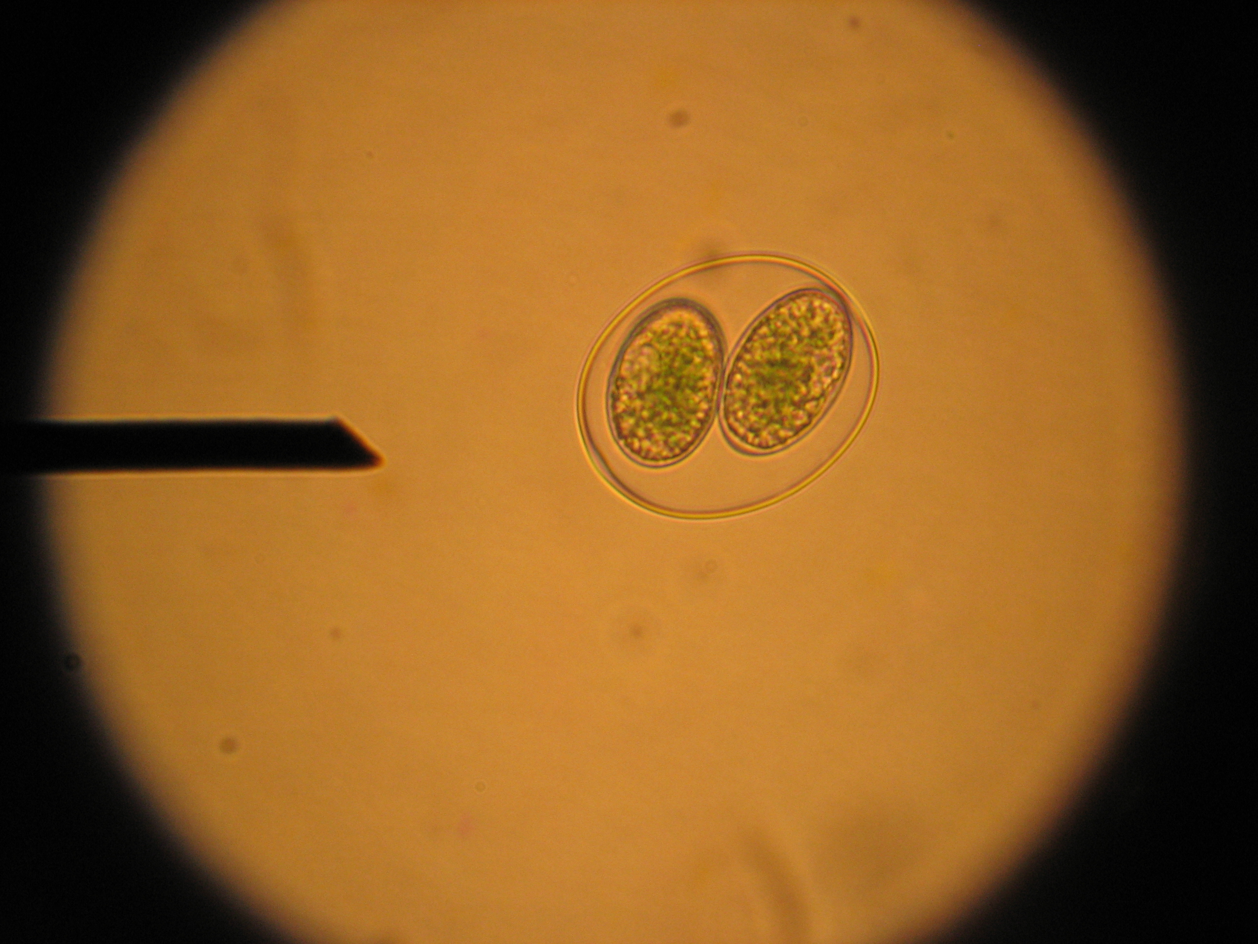 Представитель Типа Glaucophyta
